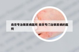 南京專治銀屑病醫(yī)院 南京專門治銀屑病的醫(yī)院