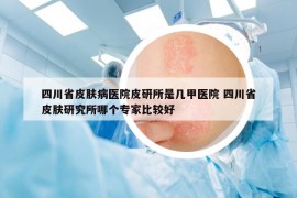 四川省皮膚病醫(yī)院皮研所是幾甲醫(yī)院 四川省皮膚研究所哪個專家比較好
