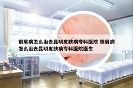 銀屑病怎么治去昆明皮膚病?？漆t(yī)院 銀屑病怎么治去昆明皮膚病?？漆t(yī)院醫(yī)生