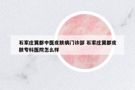石家莊冀都中醫(yī)皮膚病門(mén)診部 石家莊冀都皮膚?？漆t(yī)院怎么樣