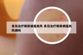 青島治療銀屑病是南風 青島治療銀屑病是南風病嗎