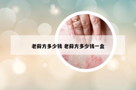 老蘚方多少錢(qián) 老蘚方多少錢(qián)一盒