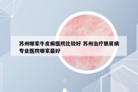 蘇州哪家牛皮癬醫(yī)院比較好 蘇州治療銀屑病專業(yè)醫(yī)院哪家最好