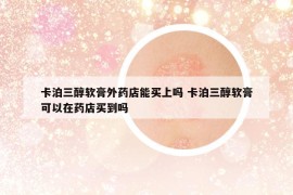 卡泊三醇軟膏外藥店能買上嗎 卡泊三醇軟膏可以在藥店買到嗎