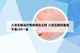 八寶五膽治療銀屑病怎么樣 八寶五膽藥墨是不是198一盒