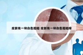 皮膚有一塊白色粗糙 皮膚有一塊白色粗糙癢