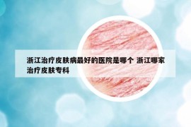 浙江治療皮膚病最好的醫(yī)院是哪個 浙江哪家治療皮膚?？? /></a>		
		</figure>

		<header class=