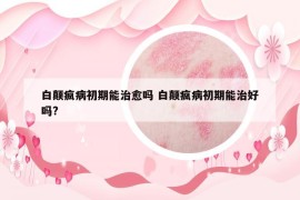 白顛瘋病初期能治愈嗎 白顛瘋病初期能治好嗎?