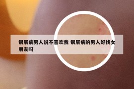 銀屑病男人說不喜歡我 銀屑病的男人好找女朋友嗎