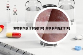 生物制劑屬于封閉針嗎 生物制劑是打針嗎