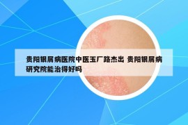 貴陽(yáng)銀屑病醫(yī)院中醫(yī)玉廠路杰出 貴陽(yáng)銀屑病研究院能治得好嗎