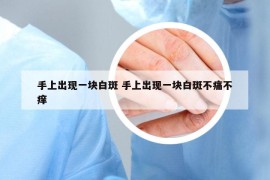 手上出現(xiàn)一塊白斑 手上出現(xiàn)一塊白斑不痛不癢