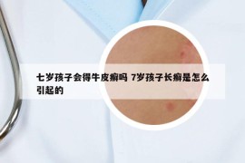 七歲孩子會(huì)得牛皮癬嗎 7歲孩子長癬是怎么引起的
