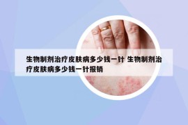 生物制劑治療皮膚病多少錢一針 生物制劑治療皮膚病多少錢一針報(bào)銷