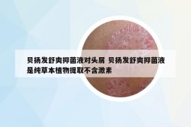 貝揚發(fā)舒爽抑菌液對頭屑 貝揚發(fā)舒爽抑菌液是純草本植物提取不含激素