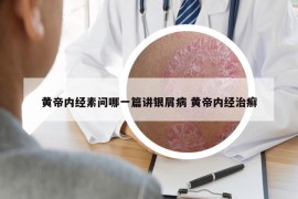 黃帝內(nèi)經(jīng)素問哪一篇講銀屑病 黃帝內(nèi)經(jīng)治癬