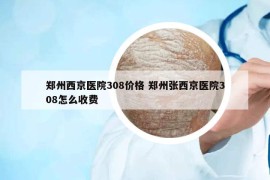 鄭州西京醫(yī)院308價(jià)格 鄭州張西京醫(yī)院308怎么收費(fèi)
