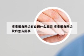 寶寶嘴角兩邊有白斑什么原因 寶寶嘴角兩邊發(fā)白怎么回事