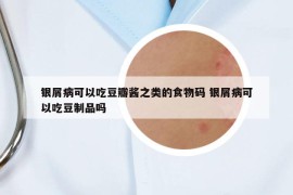 銀屑病可以吃豆瓣醬之類的食物碼 銀屑病可以吃豆制品嗎
