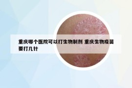 重慶哪個醫(yī)院可以打生物制劑 重慶生物疫苗要打幾針