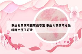 重慶兒童醫(yī)院銀屑病專家 重慶兒童醫(yī)院皮膚科哪個醫(yī)生好些