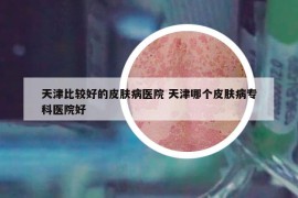 天津比較好的皮膚病醫(yī)院 天津哪個(gè)皮膚病?？漆t(yī)院好