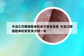 卡泊三萬蹲倍他米松本次膏有及素 卡泊三醇倍他米松軟膏多少錢一支