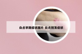 白點(diǎn)早期癥狀圖片 白點(diǎn)初發(fā)癥狀