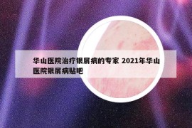 華山醫(yī)院治療銀屑病的專家 2021年華山醫(yī)院銀屑病貼吧