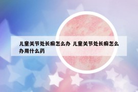 兒童關(guān)節(jié)處長癬怎么辦 兒童關(guān)節(jié)處長癬怎么辦用什么藥