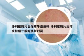 沙利度胺片會加重牛皮癬嗎 沙利度胺片治療皮膚病一般吃多長時間