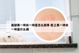 面部黑一塊白一塊是怎么回事 臉上黑一塊白一塊是什么病
