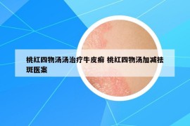 桃紅四物湯湯治療牛皮癬 桃紅四物湯加減祛斑醫(yī)案