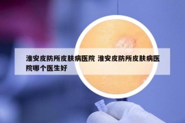 淮安皮防所皮膚病醫(yī)院 淮安皮防所皮膚病醫(yī)院哪個醫(yī)生好