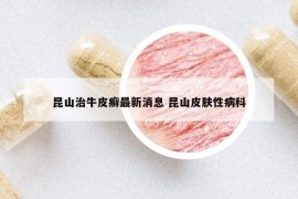 昆山治牛皮癬最新消息 昆山皮膚性病科