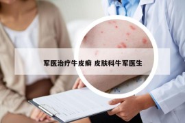 軍醫(yī)治療牛皮癬 皮膚科牛軍醫(yī)生