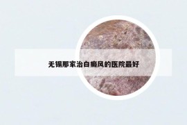 無錫那家治白癜風(fēng)的醫(yī)院最好