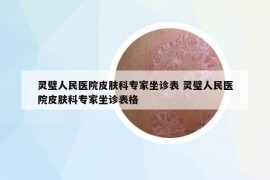 靈璧人民醫(yī)院皮膚科專(zhuān)家坐診表 靈璧人民醫(yī)院皮膚科專(zhuān)家坐診表格