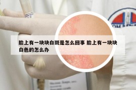 臉上有一塊塊白斑是怎么回事 臉上有一塊塊白色的怎么辦