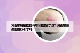濟(jì)南銀屑病醫(yī)院有哪些醫(yī)院比較好 濟(jì)南銀屑病醫(yī)院改名了嗎