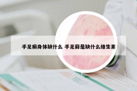 手足癬身體缺什么 手足蘚是缺什么維生素