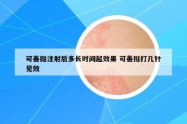 可善挺注射后多長(zhǎng)時(shí)間起效果 可善挺打幾針見效