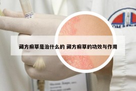 藏方癬草是治什么的 藏方癬草的功效與作用