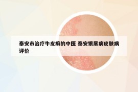 泰安市治療牛皮癬的中醫(yī) 泰安銀屑病皮膚病評價