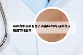 葫蘆島牛皮癬有想去海南66的嗎 葫蘆島皮膚病?？漆t(yī)院