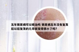五年銀屑病可以根治嗎 銀屑病五年沒(méi)有復(fù)發(fā)后以后復(fù)發(fā)的幾率就變得很小了嗎?