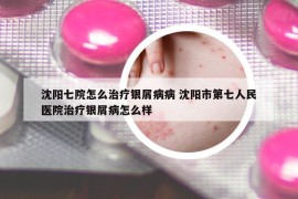 沈陽七院怎么治療銀屑病病 沈陽市第七人民醫(yī)院治療銀屑病怎么樣