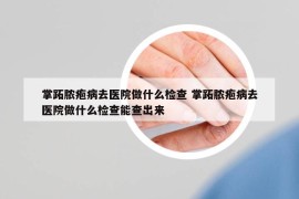掌跖膿皰病去醫(yī)院做什么檢查 掌跖膿皰病去醫(yī)院做什么檢查能查出來