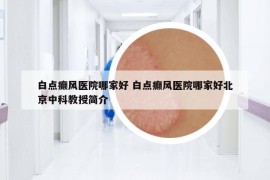 白點癲風(fēng)醫(yī)院哪家好 白點癲風(fēng)醫(yī)院哪家好北京中科教授簡介