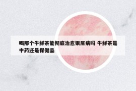 喝那個牛鮮茶能徹底治愈銀屑病嗎 牛鮮茶是中藥還是保健品